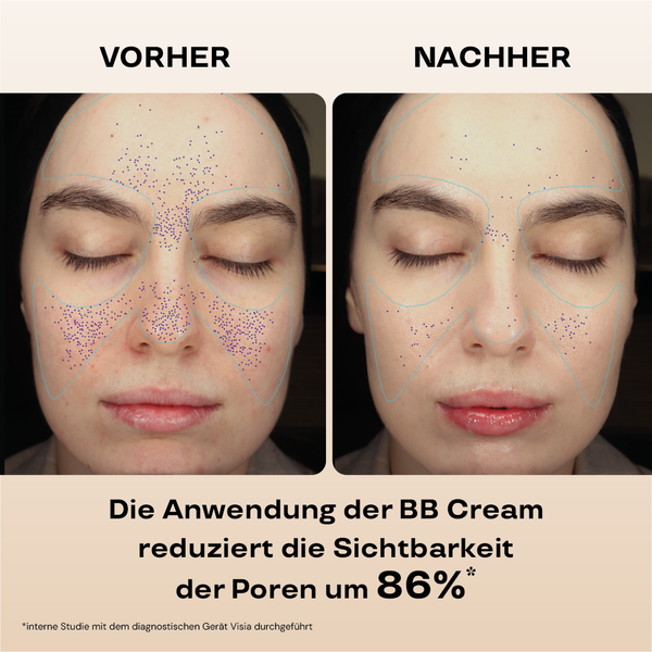 Feuchtigkeitsspendende BB Cream LSF 15 (110/Light) 